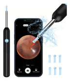 EAR WAX REMOVAL WITH CAMERA